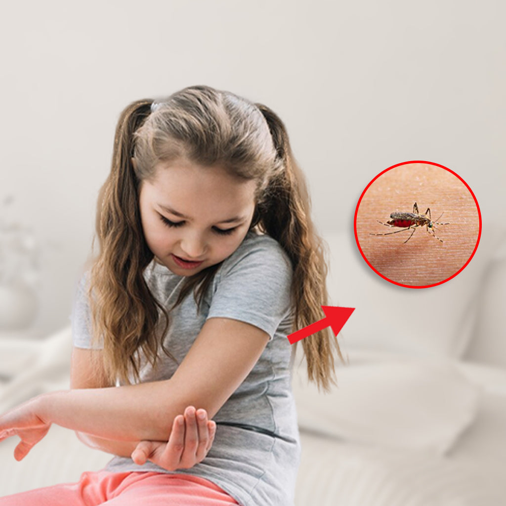 Remedies For Mosquito Bites In children